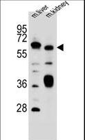 SLC2A13 / HMIT / GLUT13 Antibody - SLC2A13 Antibody western blot of mouse liver,kidney tissue lysates (35 ug/lane). The SLC2A13 antibody detected the SLC2A13 protein (arrow).