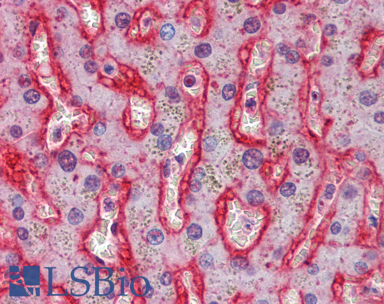 SLC2A2 / GLUT2 Antibody - Anti-GLUT2 antibody IHC of human liver. Immunohistochemistry of formalin-fixed, paraffin-embedded tissue after heat-induced antigen retrieval. Antibody concentration 2.5 ug/ml.