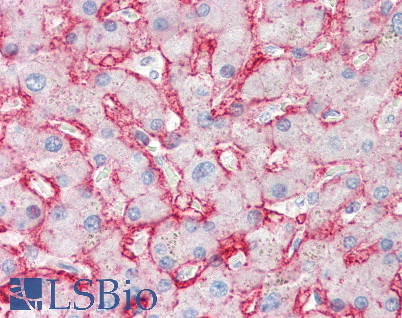 SLC2A2 / GLUT2 Antibody - Anti-GLUT2 antibody IHC of human liver. Immunohistochemistry of formalin-fixed, paraffin-embedded tissue after heat-induced antigen retrieval. Antibody concentration 10 ug/ml.