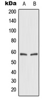 SLC2A2 / GLUT2 Antibody - Western blot analysis of GLUT2 expression in HEK293T (A); rat kidney (B) whole cell lysates.