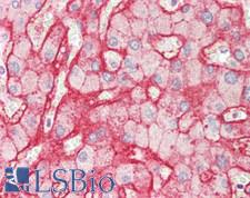 SLC2A2 / GLUT2 Antibody - Human Liver: Formalin-Fixed, Paraffin-Embedded (FFPE)