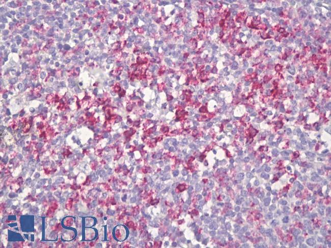 SLC2A3 / GLUT3 Antibody - Anti-SLC2A3 / GLUT3 antibody IHC of human tonsil, germinal center. Immunohistochemistry of formalin-fixed, paraffin-embedded tissue after heat-induced antigen retrieval. Antibody dilution 1:100.