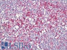 SLC2A3 / GLUT3 Antibody - Anti-SLC2A3 / GLUT3 antibody IHC of human tonsil, germinal center. Immunohistochemistry of formalin-fixed, paraffin-embedded tissue after heat-induced antigen retrieval. Antibody dilution 1:100.