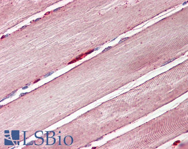 SLC2A4 / GLUT-4 Antibody - Anti-GLUT4 antibody IHC of human skeletal muscle. Immunohistochemistry of formalin-fixed, paraffin-embedded tissue after heat-induced antigen retrieval. Antibody dilution 3.75 ug/ml.