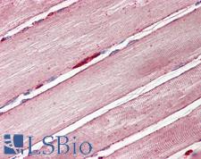 SLC2A4 / GLUT-4 Antibody - Anti-GLUT4 antibody IHC of human skeletal muscle. Immunohistochemistry of formalin-fixed, paraffin-embedded tissue after heat-induced antigen retrieval. Antibody dilution 3.75 ug/ml.