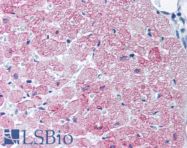 SLC2A4 / GLUT-4 Antibody - Anti-SLC2A4 / GLUT4 antibody IHC of human heart, cardiac myocytes. Immunohistochemistry of formalin-fixed, paraffin-embedded tissue after heat-induced antigen retrieval. Antibody concentration 20 ug/ml.