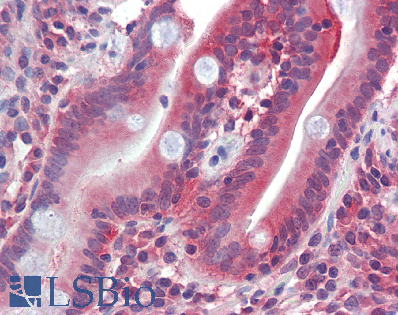 SLC2A5 / GLUT5 Antibody - Anti-SLC2A5 / GLUT5 antibody IHC of human small intestine. Immunohistochemistry of formalin-fixed, paraffin-embedded tissue after heat-induced antigen retrieval. Antibody concentration 2.5 ug/ml.