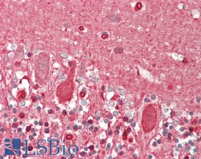 SLC2A6 / GLUT6 Antibody - Human Brain, Cerebellum: Formalin-Fixed, Paraffin-Embedded (FFPE)