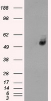 SLC2A6 / GLUT6 Antibody - HEK293T cells were transfected with the pCMV6-ENTRY control (Left lane) or pCMV6-ENTRY SLC2A6 (Right lane) cDNA for 48 hrs and lysed. Equivalent amounts of cell lysates (5 ug per lane) were separated by SDS-PAGE and immunoblotted with anti-SLC2A6.