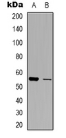 SLC30A1 / ZNT1 Antibody - Western blot analysis of ZNT1 expression in HepG2 (A); U251 (B) whole cell lysates.