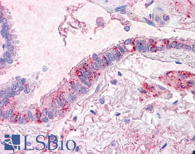SLC31A1 / CTR1 Antibody - Anti-CTR1 antibody IHC of human lung, respiratory epithelium. Immunohistochemistry of formalin-fixed, paraffin-embedded tissue after heat-induced antigen retrieval.