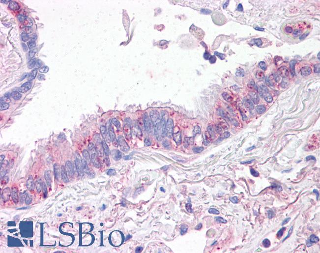 SLC31A1 / CTR1 Antibody - Anti-CTR1 antibody IHC of human lung, respiratory epithelium. Immunohistochemistry of formalin-fixed, paraffin-embedded tissue after heat-induced antigen retrieval.