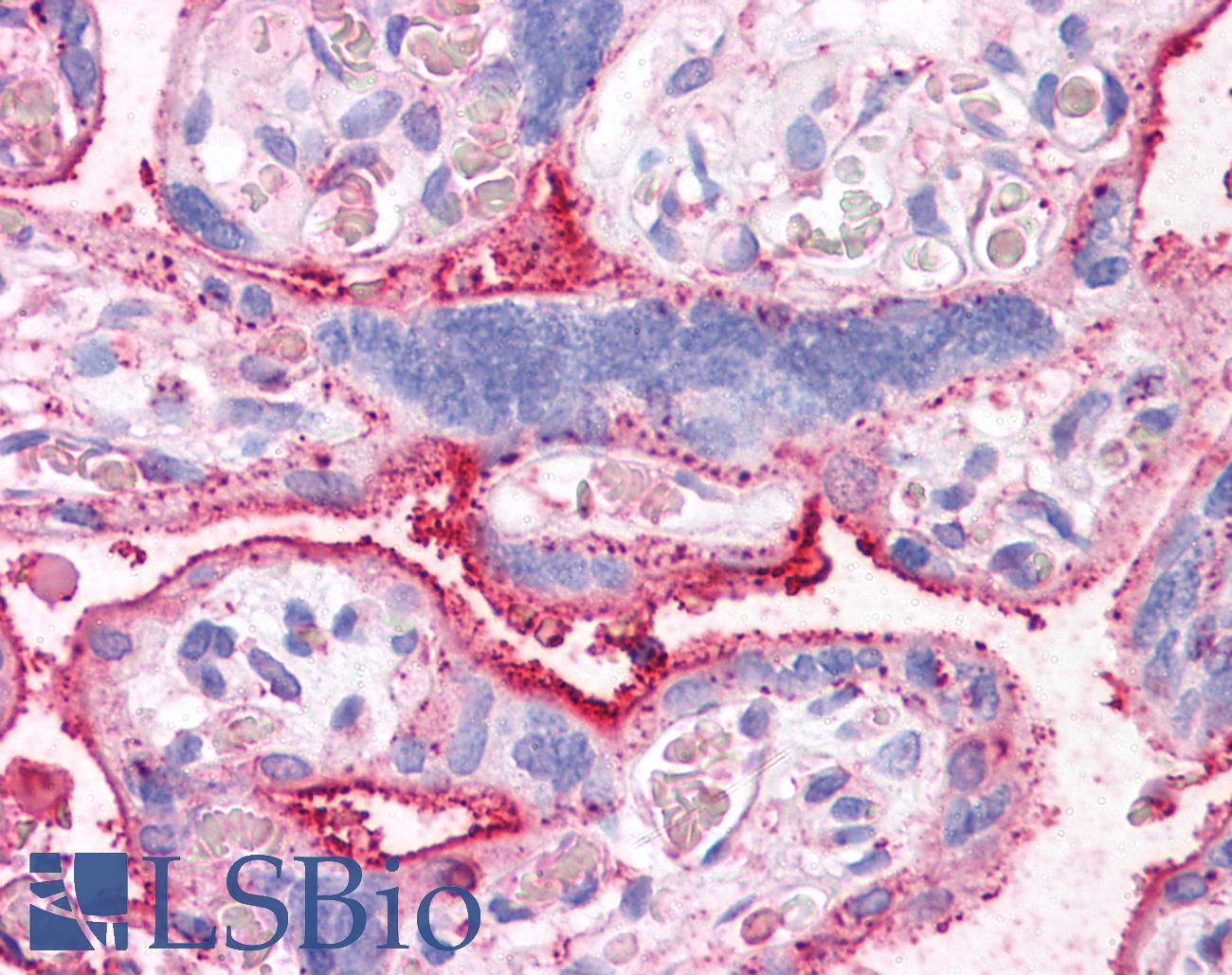 SLC31A1 / CTR1 Antibody - Anti-CTR1 antibody IHC of human placenta. Immunohistochemistry of formalin-fixed, paraffin-embedded tissue after heat-induced antigen retrieval.