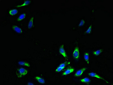 SLC31A2 Antibody - Immunofluorescent analysis of Hela cells using SLC31A2 Antibody at dilution of 1:100 and Alexa Fluor 488-congugated AffiniPure Goat Anti-Rabbit IgG(H+L)