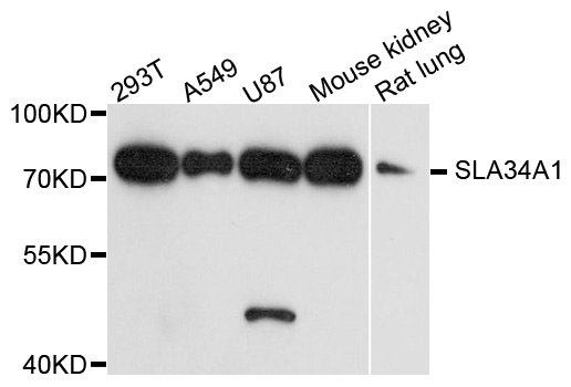 SLC34A1 / NPT2 Antibody - Western blot analysis of extracts of various cells.