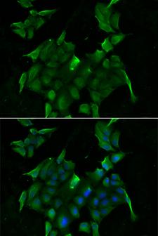 SLC34A1 / NPT2 Antibody - Immunofluorescence analysis of HeLa cells.