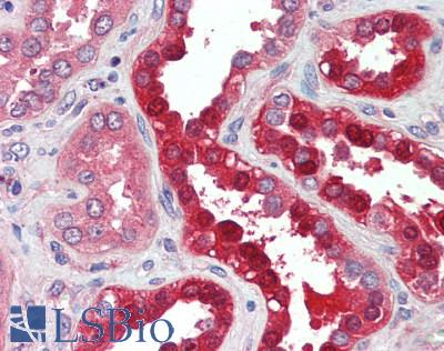 SLC34A1 / NPT2 Antibody - Human Kidney: Formalin-Fixed, Paraffin-Embedded (FFPE)