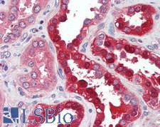 SLC34A1 / NPT2 Antibody - Human Kidney: Formalin-Fixed, Paraffin-Embedded (FFPE)