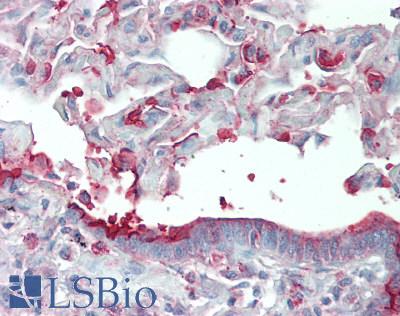 SLC34A2 / NaPi-2b Antibody - Human Lung: Formalin-Fixed, Paraffin-Embedded (FFPE), at a concentration of 10 ug/ml