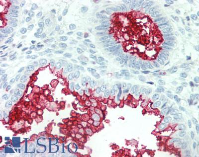 SLC34A2 / NaPi-2b Antibody - Human Uterus: Formalin-Fixed, Paraffin-Embedded (FFPE), at a concentration of 10 ug/ml