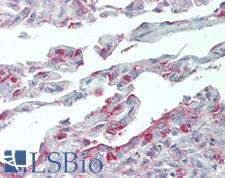 SLC34A2 / NaPi-2b Antibody - Human Lung: Formalin-Fixed, Paraffin-Embedded (FFPE), at a concentration of 10 ug/ml