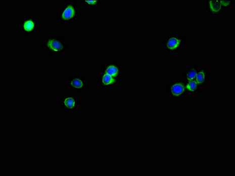 SLC35A2 / UGT Antibody - Immunofluorescent analysis of HepG2 cells using SLC35A2 Antibody at a dilution of 1:100 and Alexa Fluor 488-congugated AffiniPure Goat Anti-Rabbit IgG(H+L)