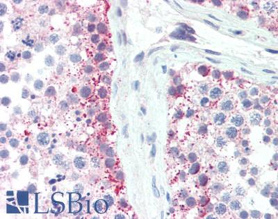 SLC35A2 / UGT Antibody - Human Testis: Formalin-Fixed, Paraffin-Embedded (FFPE), at a concentration of 10 ug/ml. 