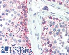 SLC35A2 / UGT Antibody - Human Testis: Formalin-Fixed, Paraffin-Embedded (FFPE), at a concentration of 10 ug/ml. 
