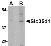 SLC35D1 Antibody - Western blot of Slc35D1 in Daudi lysate with Slc35D1 antibody at (A) 1 and (B) 2 ug/ml.