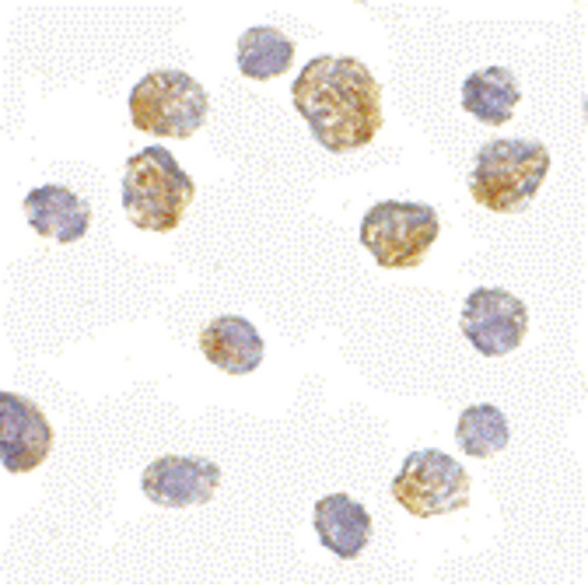 SLC35D1 Antibody - Immunocytochemistry of Slc35D1 in Daudi cells with Slc35D1 antibody at 5 ug/ml.