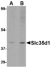 SLC35D1 Antibody - Western blot of Slc35D1 in A-20 lysate with Slc35D1 antibody at (A) 1 and (B) 2 ug/ml.
