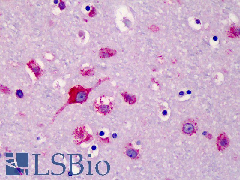 SLC35D1 Antibody - Anti-SLC35D1 antibody IHC of human brain, cortex. Immunohistochemistry of formalin-fixed, paraffin-embedded tissue after heat-induced antigen retrieval. Antibody concentration 5 ug/ml.