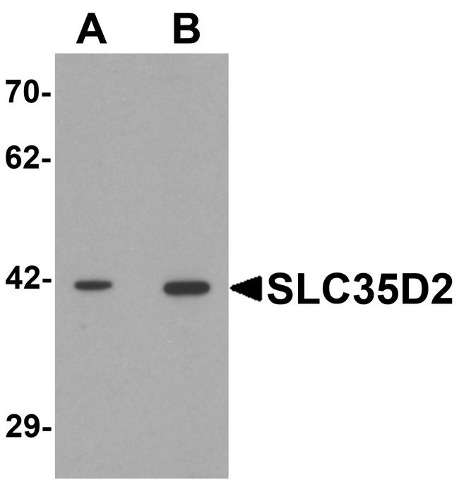 SLC35D2 Antibody - Western blot analysis of SLC35D2 in HeLa cell lysate with SLC35D2 antibody at (A) 1 and (B) 2 ug/ml.