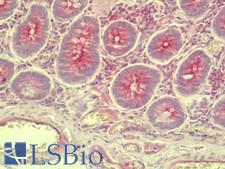 SLC35D3 / FRCL1 Antibody - Anti-SLC35D3 / FRCL1 antibody IHC staining of human small intestine. Immunohistochemistry of formalin-fixed, paraffin-embedded tissue after heat-induced antigen retrieval. Antibody concentration 5 ug/ml.