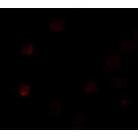 SLC35D3 / FRCL1 Antibody - Immunofluorescence of SLC35D3 in HeLa cells with SLC35D3 antibody at 5 µg/mL.