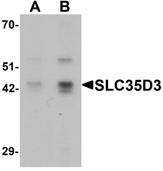 SLC35D3 / FRCL1 Antibody - Western blot analysis of SLC35D3 in HeLa cell lysate with SLC35D3 antibody at (A) 1 and (B) 2 ug/ml.