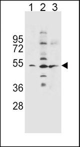 SLC36A1 Antibody - SLC36A1 Antibody western blot of NCI-H460(lane 1),K562(lane 2),A549(lane 3) cell line lysates (35 ug/lane). The SLC36A1 antibody detected the SLC36A1 protein (arrow).