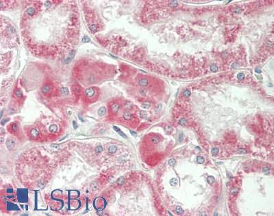 SLC36A2 Antibody - Human Kidney: Formalin-Fixed, Paraffin-Embedded (FFPE)