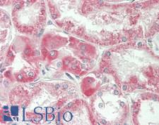 SLC36A2 Antibody - Human Kidney: Formalin-Fixed, Paraffin-Embedded (FFPE)