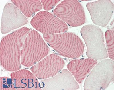 SLC36A2 Antibody - Human Skeletal Muscle: Formalin-Fixed, Paraffin-Embedded (FFPE)