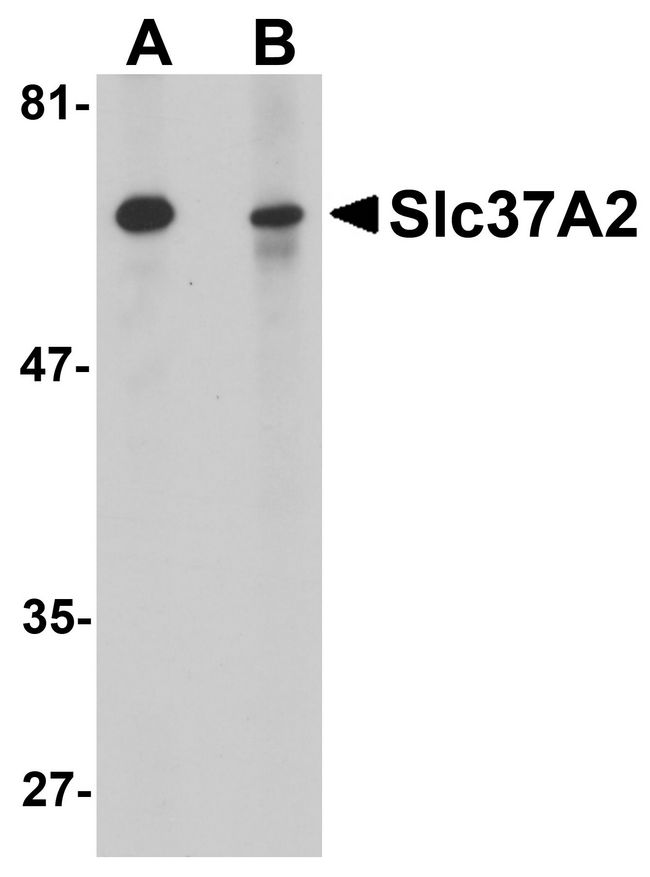 SLC37A2 Antibody - Western blot analysis of Slc37A2 in mouse spleen tissue lysate with Slc37A2 antibody at 1 ug/ml in the (A) absence and (B) presence of blocking peptide.