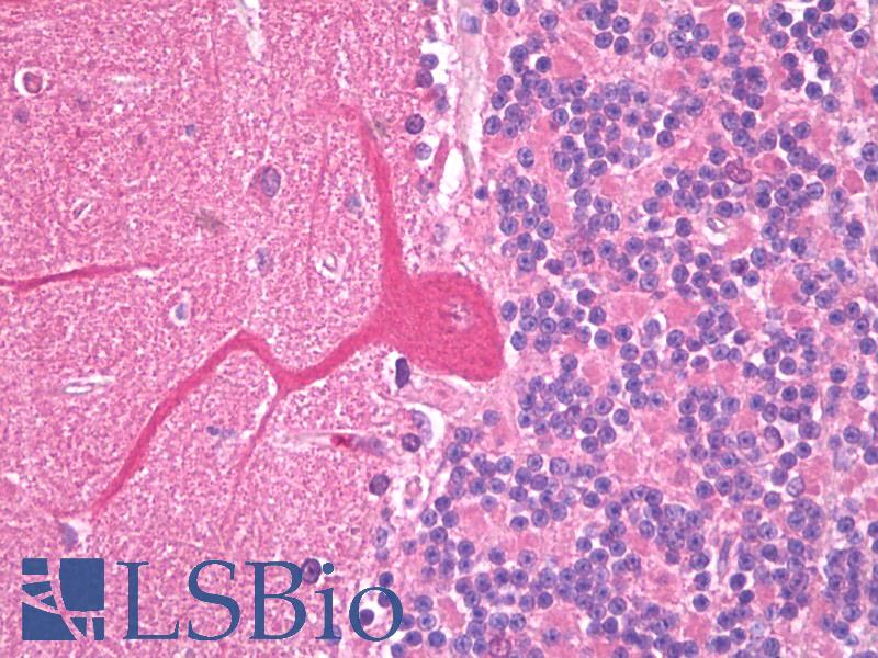 SLC38A1 / NaT2 Antibody - Anti-SLC38A1 antibody IHC of human brain, cerebellum, Purkinje. Immunohistochemistry of formalin-fixed, paraffin-embedded tissue after heat-induced antigen retrieval. Antibody concentration 10 ug/ml.  This image was taken for the unconjugated form of this product. Other forms have not been tested.