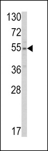 SLC38A3 / SNAT3 Antibody - Western blot of SLC38A3 Antibody in HepG2 cell line lysates (35 ug/lane). SLC38A3 (arrow) was detected using the purified antibody.
