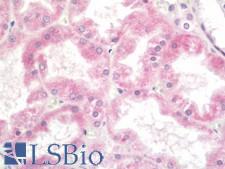 SLC38A3 / SNAT3 Antibody - Human Kidney: Formalin-Fixed, Paraffin-Embedded (FFPE)