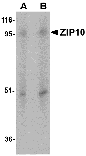 SLC39A10 / ZIP10 Antibody - Western blot of ZIP10 in human spleen tissue lysate with ZIP10 antibody at (A) 1 and (B) 2 ug/ml.