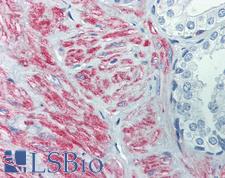 SLC39A10 / ZIP10 Antibody - Anti-SLC39A10 antibody IHC of human prostate. Immunohistochemistry of formalin-fixed, paraffin-embedded tissue after heat-induced antigen retrieval. Antibody concentration 5 ug/ml.