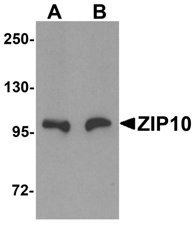 SLC39A10 / ZIP10 Antibody - Western blot analysis of ZIP10 in human spleen tissue lysate with ZIP10 antibody at (A) 1 and (B) 2 ug/ml.