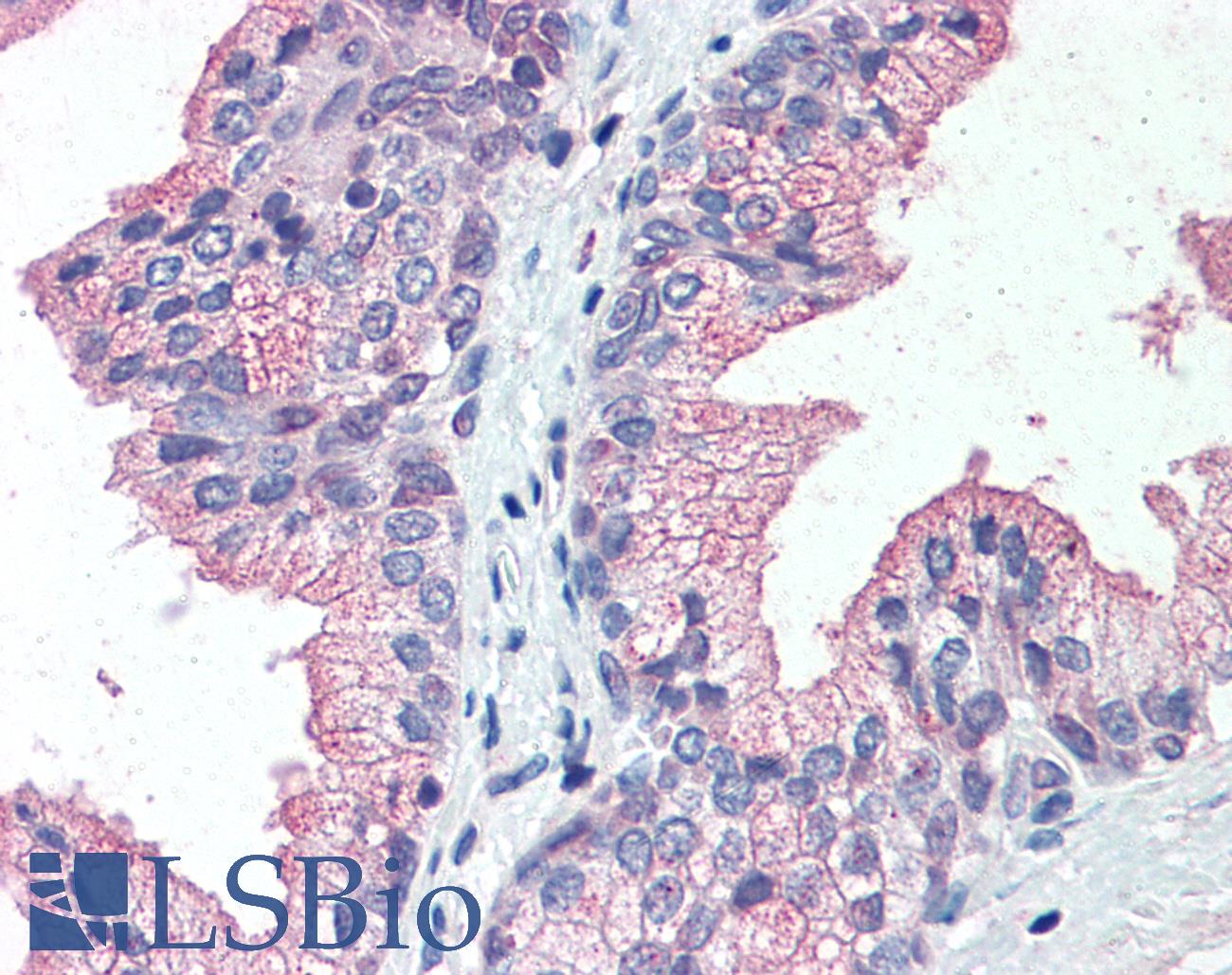 SLC39A14 / ZIP14 Antibody - Anti-SLC39A14 antibody IHC of human prostate. Immunohistochemistry of formalin-fixed, paraffin-embedded tissue after heat-induced antigen retrieval.