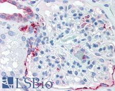 SLC39A14 / ZIP14 Antibody - Anti-SLC39A14 antibody IHC of human kidney. Immunohistochemistry of formalin-fixed, paraffin-embedded tissue after heat-induced antigen retrieval.