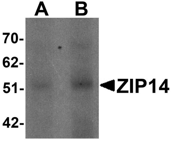 SLC39A14 / ZIP14 Antibody - Western blot analysis of ZIP14 in human spleen tissue lysate with ZIP14 antibody at (A) 1 and (B) 2 ug/ml.